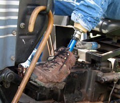 Image of farmer with prosthetic foot.